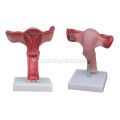 MAGNIFIED UTERUS MODEL